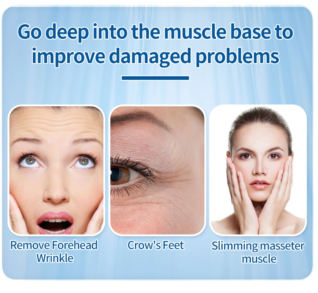 Premium Supplier Anti Wrinkle Lyophilized Powder for Brow Lifting Forehead Wrinkles Crows Feet